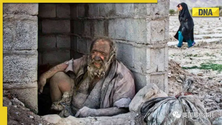 “全球最脏的人”终于洗了67年来第一个澡，结果，洗完就去世了……