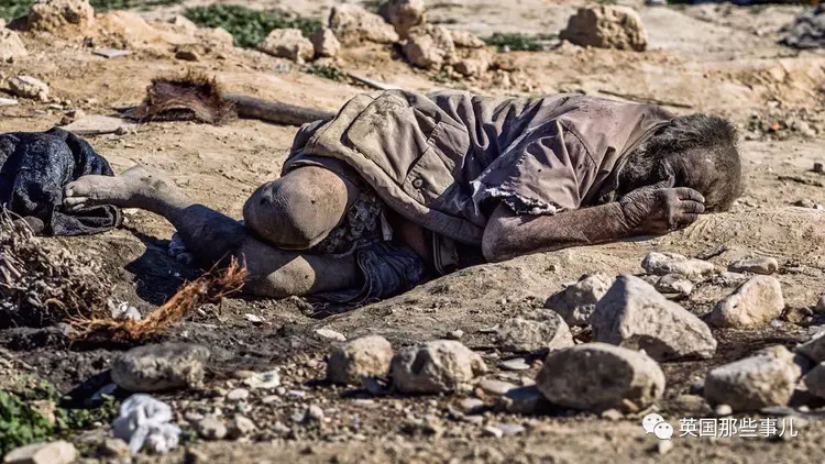 “全球最脏的人”终于洗了67年来第一个澡，结果，洗完就去世了……