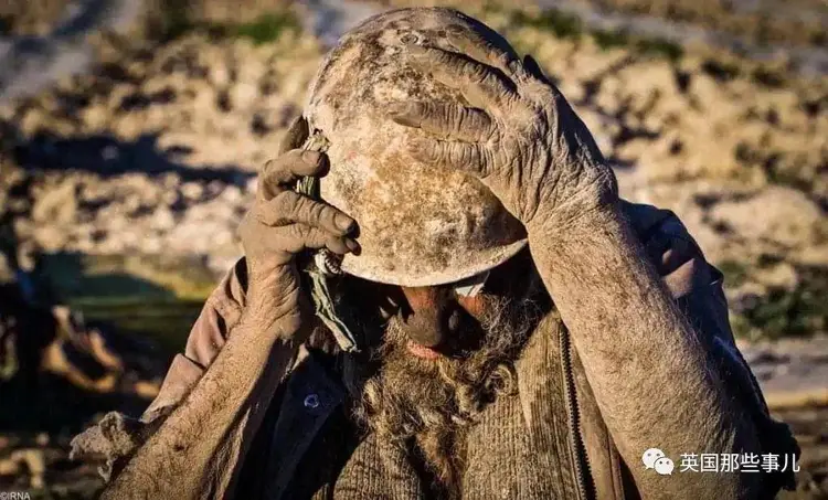 “全球最脏的人”终于洗了67年来第一个澡，结果，洗完就去世了……